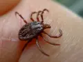 Zecca scura su pelle umana, potenziale vettore di ehrlichia canis.